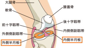 半月板損傷とは
