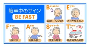 脳梗塞の初期症状とは？前触れ・BEFASTチェック・受診目安を解説